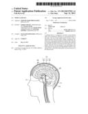 MEDICAL DEVICE diagram and image