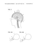 MEDICAL DEVICE diagram and image