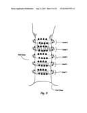 SYSTEMS AND METHODS FOR TREATING TISSUE WITH RADIOFREQUENCY ENERGY diagram and image