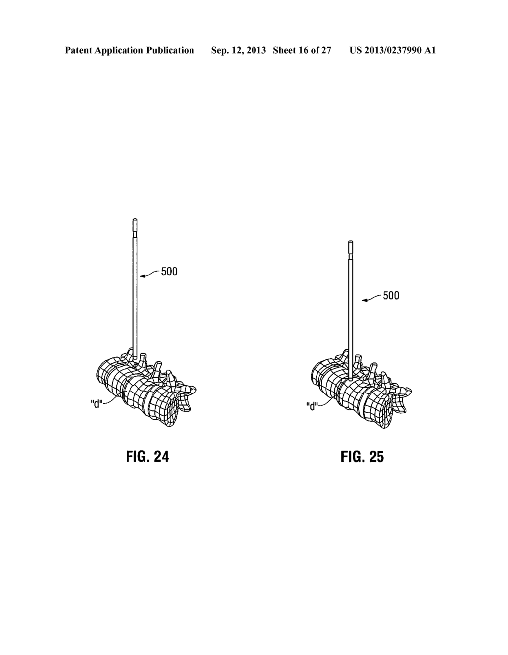 LATERAL ACCESS SYSTEM AND METHOD OF USE - diagram, schematic, and image 17