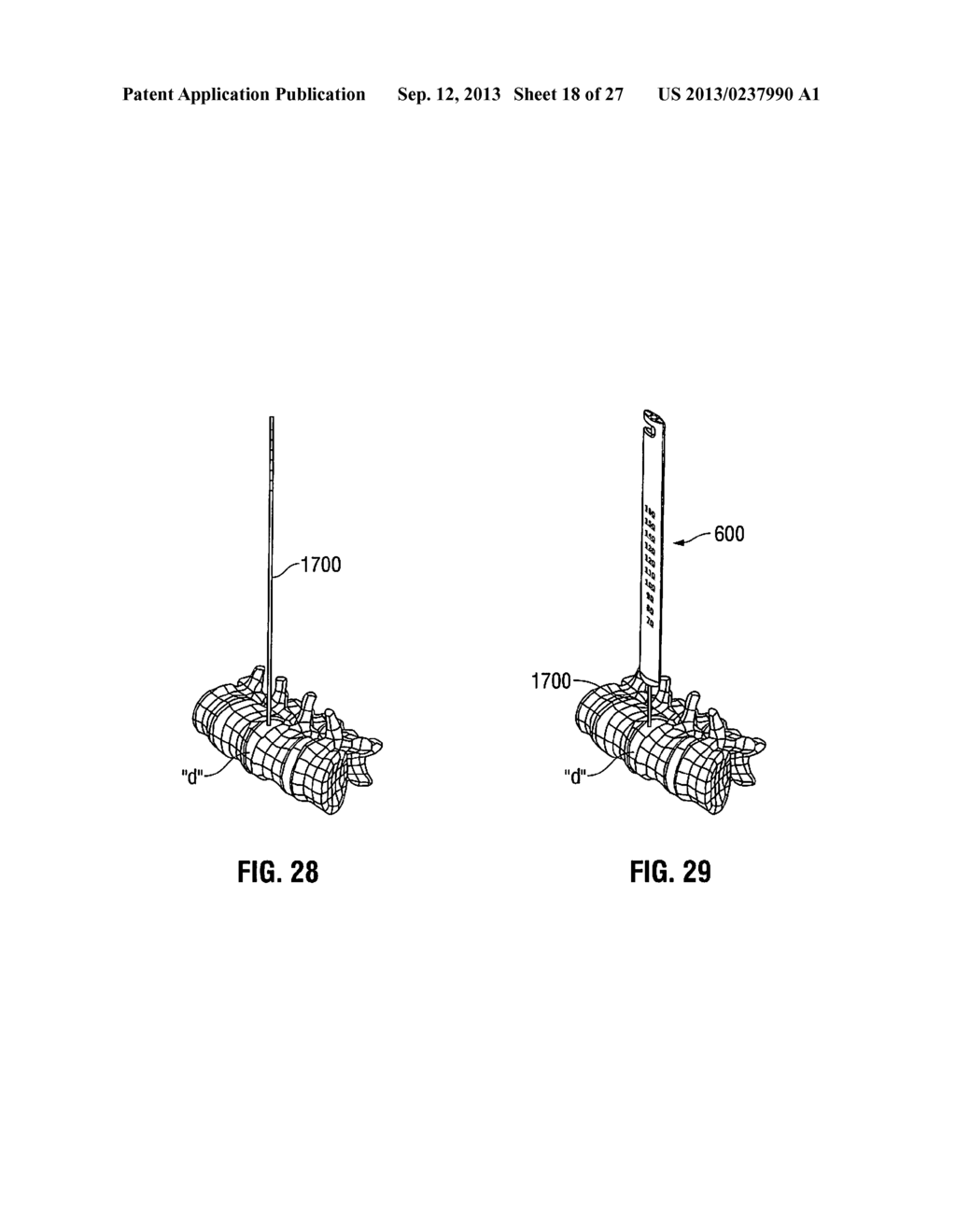 LATERAL ACCESS SYSTEM AND METHOD OF USE - diagram, schematic, and image 19