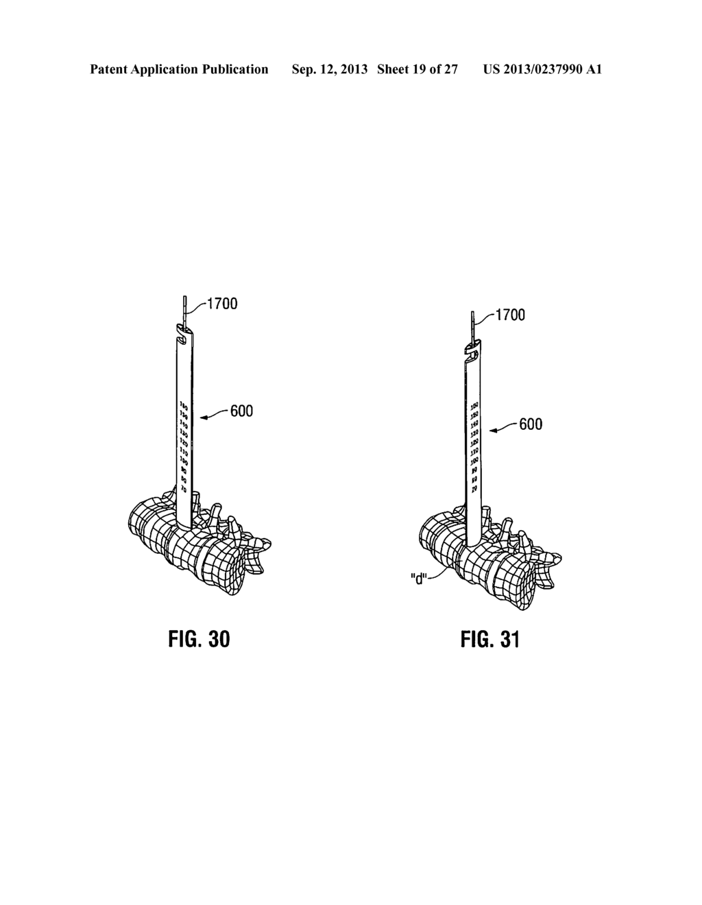 LATERAL ACCESS SYSTEM AND METHOD OF USE - diagram, schematic, and image 20