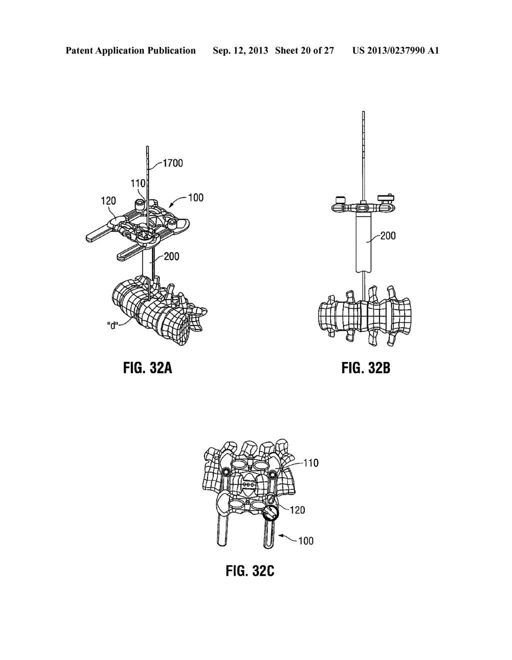 LATERAL ACCESS SYSTEM AND METHOD OF USE - diagram, schematic, and image 21