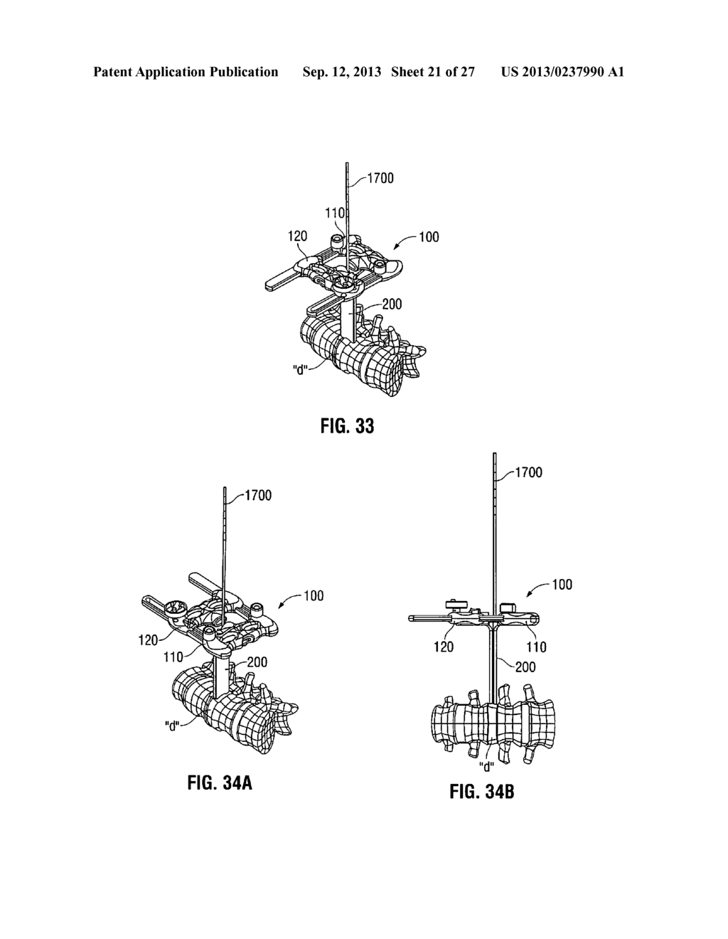 LATERAL ACCESS SYSTEM AND METHOD OF USE - diagram, schematic, and image 22