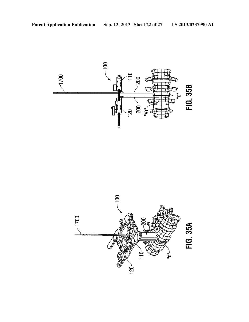 LATERAL ACCESS SYSTEM AND METHOD OF USE - diagram, schematic, and image 23