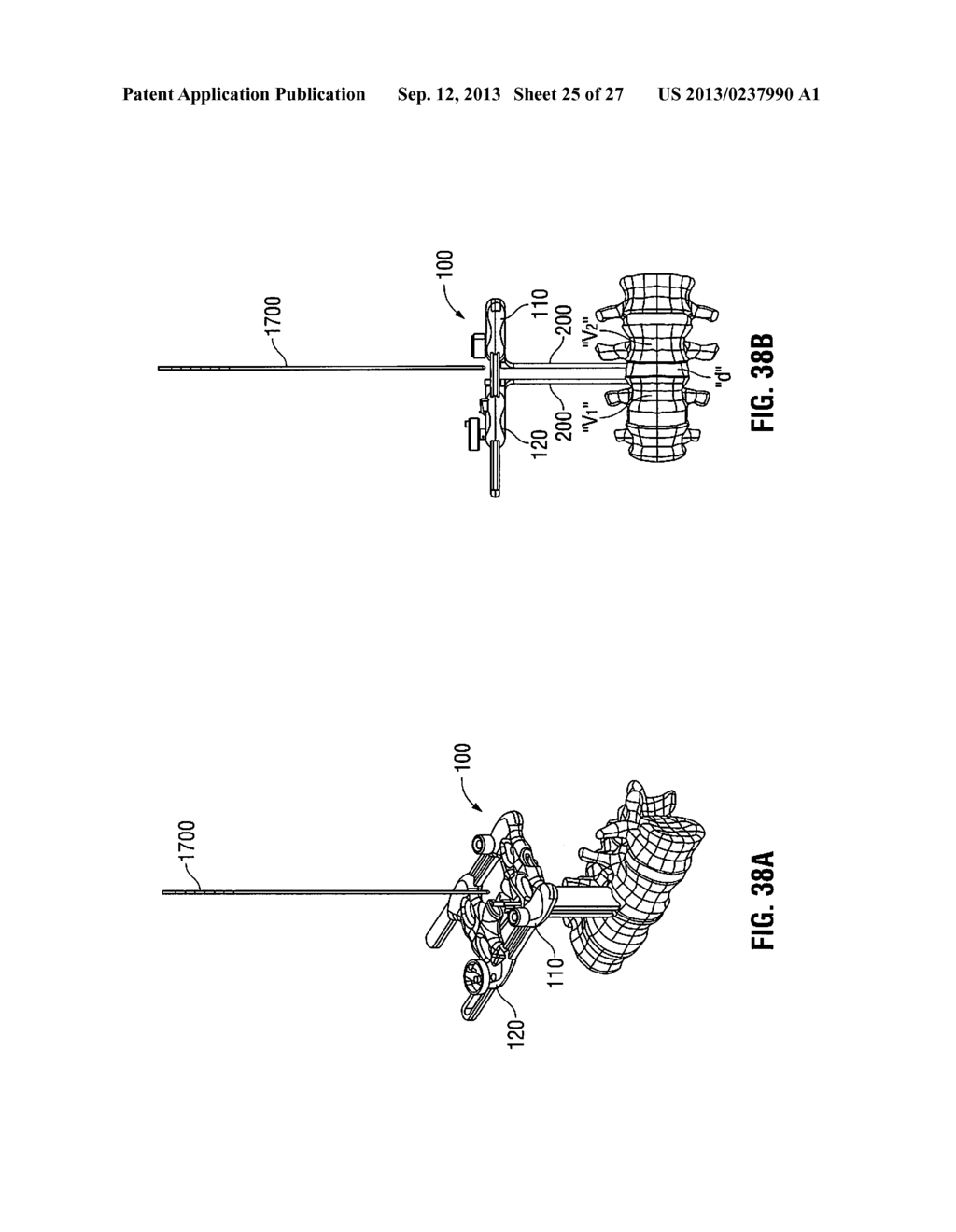 LATERAL ACCESS SYSTEM AND METHOD OF USE - diagram, schematic, and image 26