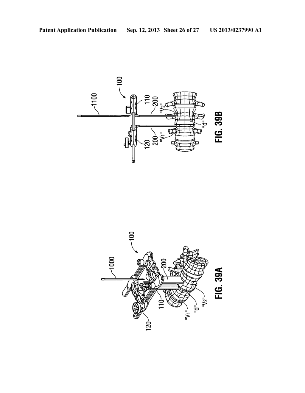 LATERAL ACCESS SYSTEM AND METHOD OF USE - diagram, schematic, and image 27