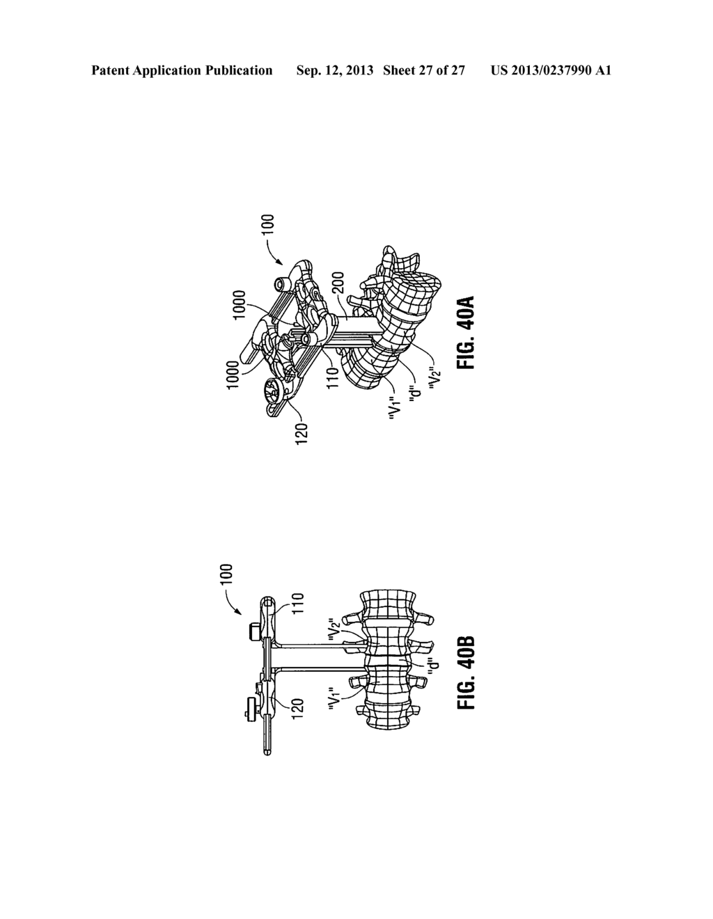 LATERAL ACCESS SYSTEM AND METHOD OF USE - diagram, schematic, and image 28