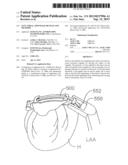LEFT ATRIAL APPENDAGE DEVICES AND METHODS diagram and image