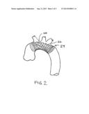 EMBOLIC PROTECTION DEVICE diagram and image