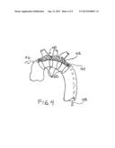 EMBOLIC PROTECTION DEVICE diagram and image