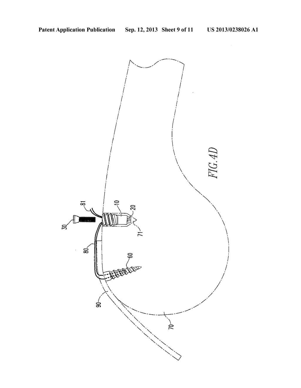 ANCHORING SYSTEM - diagram, schematic, and image 10