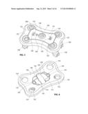 IMPLANTABLE VERTEBRAL FRAME SYSTEMS AND RELATED METHODS FOR SPINAL REPAIR diagram and image