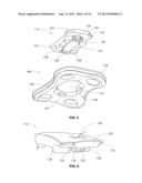 IMPLANTABLE VERTEBRAL FRAME SYSTEMS AND RELATED METHODS FOR SPINAL REPAIR diagram and image