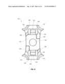 IMPLANTABLE VERTEBRAL FRAME SYSTEMS AND RELATED METHODS FOR SPINAL REPAIR diagram and image