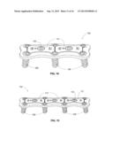 IMPLANTABLE VERTEBRAL FRAME SYSTEMS AND RELATED METHODS FOR SPINAL REPAIR diagram and image