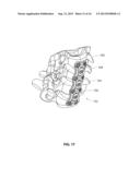 IMPLANTABLE VERTEBRAL FRAME SYSTEMS AND RELATED METHODS FOR SPINAL REPAIR diagram and image