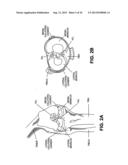 DEVICES, SYSTEMS AND METHODS FOR MENISCUS REPAIR diagram and image