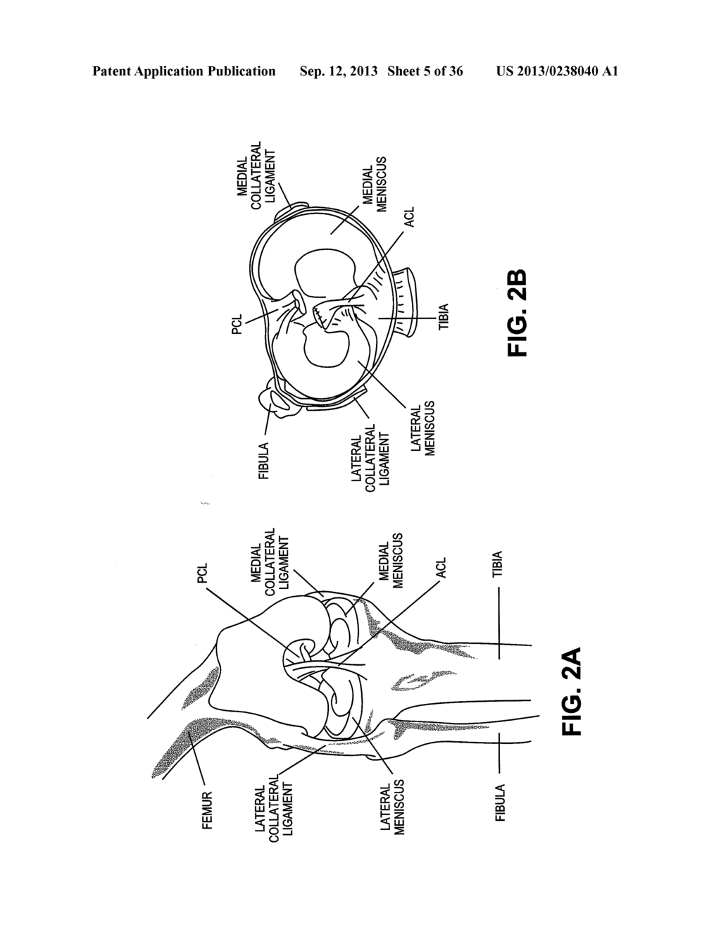 DEVICES, SYSTEMS AND METHODS FOR MENISCUS REPAIR - diagram, schematic, and image 06