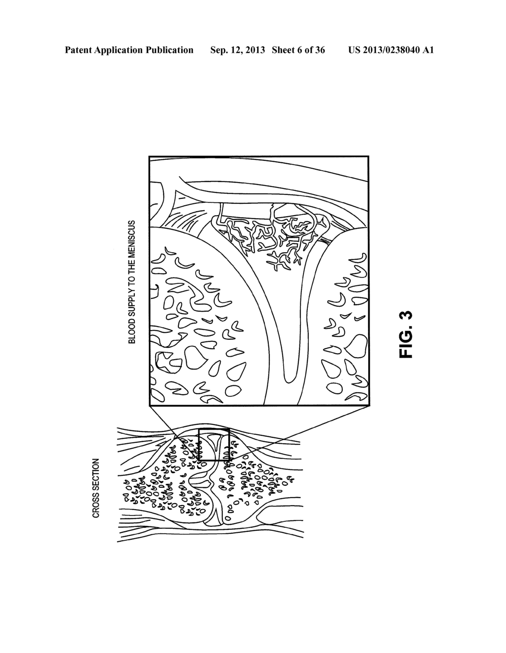 DEVICES, SYSTEMS AND METHODS FOR MENISCUS REPAIR - diagram, schematic, and image 07