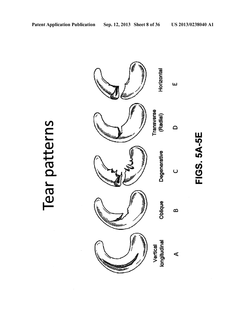 DEVICES, SYSTEMS AND METHODS FOR MENISCUS REPAIR - diagram, schematic, and image 09