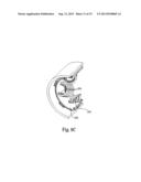 LOW INSERTION FORCE ELECTRICAL CONNECTOR FOR IMPLANTABLE MEDICAL DEVICES diagram and image