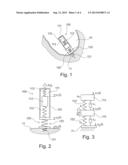 AUTONOMOUS INTRACORPOREAL CAPSULE WITH DOUBLE ENERGY HARVESTING diagram and image