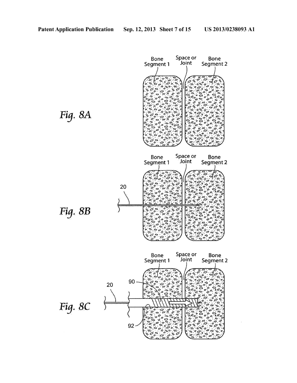 INTEGRATED IMPLANT - diagram, schematic, and image 08