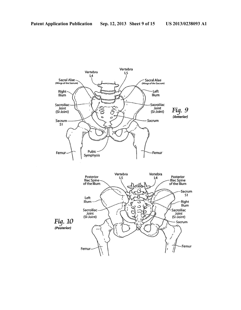 INTEGRATED IMPLANT - diagram, schematic, and image 10