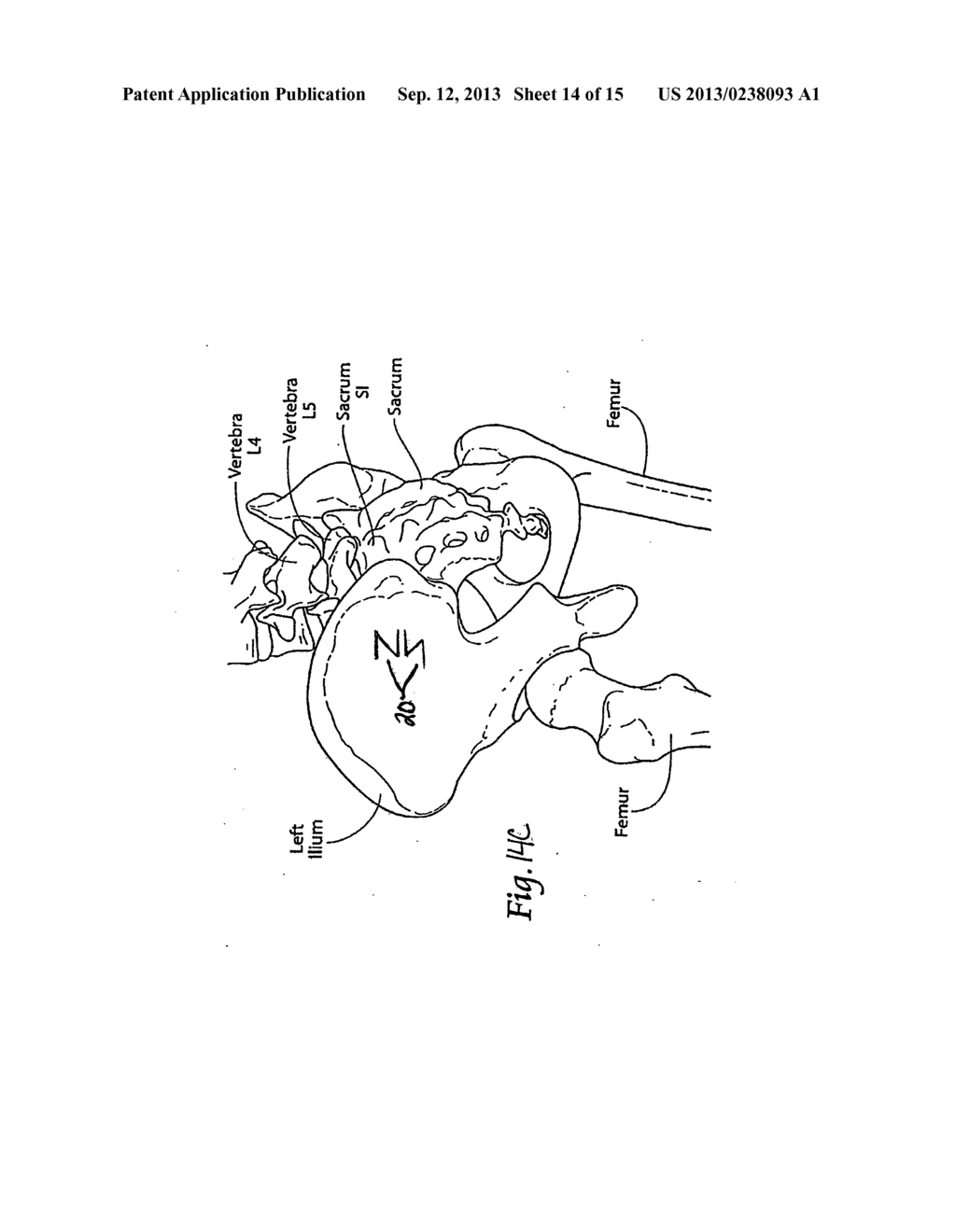 INTEGRATED IMPLANT - diagram, schematic, and image 15