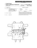 Nubbed Plate diagram and image