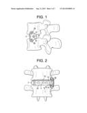 Nubbed Plate diagram and image