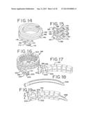 DEVICES FOR TREATING THE SPINE diagram and image