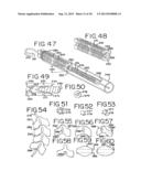 DEVICES FOR TREATING THE SPINE diagram and image