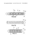 DEVICES FOR TREATING THE SPINE diagram and image