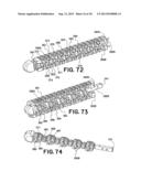 DEVICES FOR TREATING THE SPINE diagram and image