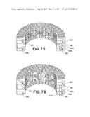 DEVICES FOR TREATING THE SPINE diagram and image