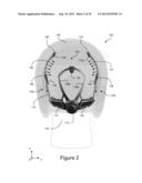 TIGHTENING SYSTEMS diagram and image