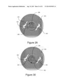 TIGHTENING SYSTEMS diagram and image