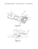 TIGHTENING SYSTEMS diagram and image