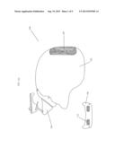 Helmet Stabilization Apparatus diagram and image