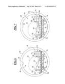 Inflation Support System for MR Guided HIFU diagram and image