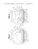 Inflation Support System for MR Guided HIFU diagram and image