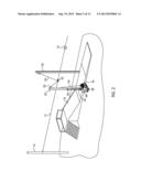 Trolley Braking System diagram and image