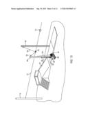 Trolley Braking System diagram and image