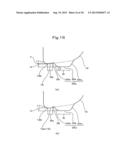 SYNTHETIC RESIN BOTTLE diagram and image