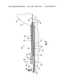 FLUID CONTAINMENT APPARATUS diagram and image