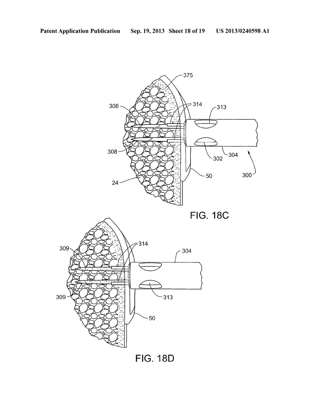 FASTENERS AND FASTENER DELIVERY DEVICES FOR AFFIXING SHEET-LIKE MATERIALS     TO BONE OR TISSUE - diagram, schematic, and image 19