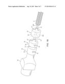 Stent Holding Fixtures diagram and image