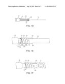 Stent Holding Fixtures diagram and image